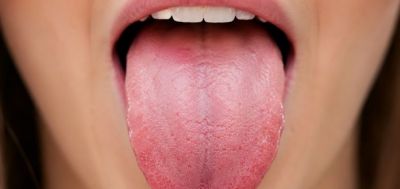 Sta boja jezika govori o oralnom zdravlju?