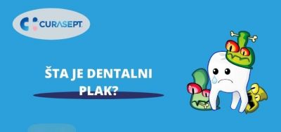 Dentalni plak - Kako nastaje i kako ga spreciti?
