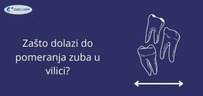 Zašto dolazi do pomeranja zuba u vilici?