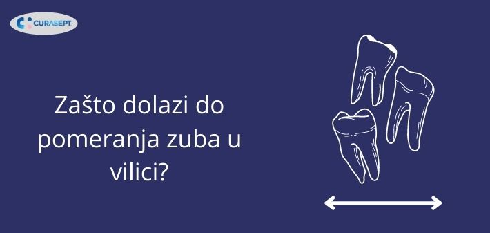 Zašto dolazi do pomeranja zuba u vilici?