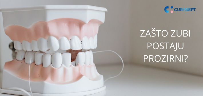 ZAŠTO ZUBI POSTAJU PROZIRNI?