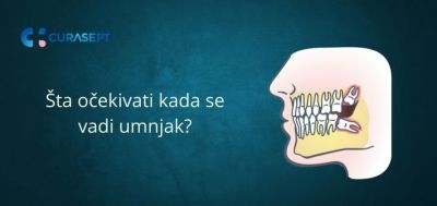 Vađenje umnjaka - Vodič za početnike