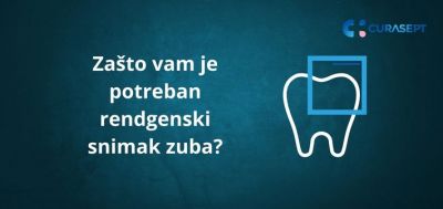 Zašto vam je potreban rendgenski snimak zuba