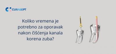 Koliko vremena je potrebno za oporavak nakon ciscenja kanala korena zuba?
